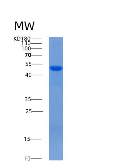 SDS-PAGE analysis of Mouse Serpinf2 (Alpha-2-Antiplasmin) - Recombinant Protein, CAT# BLT-00136P, showing >85% purity under 15% SDS-PAGE (Reduced)Mouse Serpinf2 (Alpha-2-Antiplasmin) - Recombinant Protein
