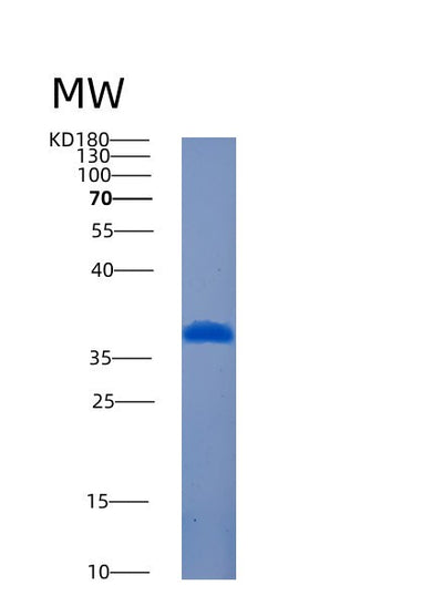 SDS-PAGE analysis of Human AMMECR1L (Ammecr1-Like Protein) - Recombinant Protein, CAT# BLT-00141P, showing >90% purity under 15% SDS-PAGE (Reduced)Human AMMECR1L (Ammecr1-Like Protein) - Recombinant Protein