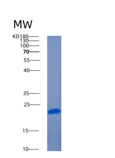 SDS-PAGE analysis of Human AMTN (Amelotin) - Recombinant Protein, CAT# BLT-00146P, showing >95% purity under 15% SDS-PAGE (Reduced)Human AMTN (Amelotin) - Recombinant Protein