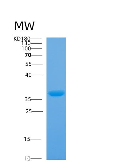 SDS-PAGE analysis of Human ANXA5 (Annexin A5) - Recombinant Protein, CAT# BLT-00163P, showing >95% purity under 15% SDS-PAGE (Reduced)Human ANXA5 (Annexin A5) - Recombinant Protein
