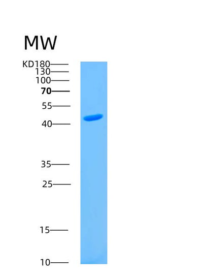 SDS-PAGE analysis of Human AS3MT (Arsenite Methyltransferase) - Recombinant Protein, CAT# BLT-00231P, showing >85% purity under 15% SDS-PAGE (Reduced)Human AS3MT (Arsenite Methyltransferase) - Recombinant Protein