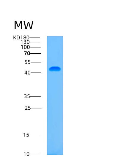 SDS-PAGE analysis of Human ASCC1 (Activating Signal Cointegrator 1 Complex Subunit 1) - Recombinant Protein, CAT# BLT-00234P, showing >85% purity under 15% SDS-PAGE (Reduced)Human ASCC1 (Activating Signal Cointegrator 1 Complex Subunit 1) - Recombinant Protein