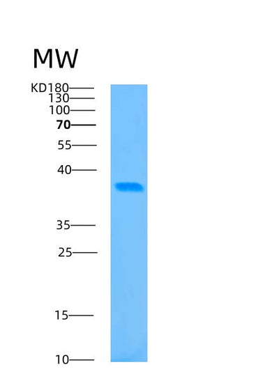SDS-PAGE analysis of Human BABAM1 (Brisc And Brca1-A Complex Member 1) - Recombinant Protein, CAT# BLT-00279P, showing >95% purity under 15% SDS-PAGE (Reduced)Human BABAM1 (Brisc And Brca1-A Complex Member 1) - Recombinant Protein