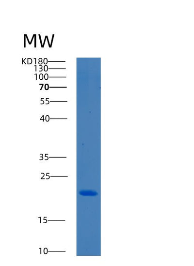 SDS-PAGE analysis of Human BCL2L10 (Bcl-2-Like Protein 10) - Recombinant Protein, CAT# BLT-00302P, showing >85% purity under 15% SDS-PAGE (Reduced)Human BCL2L10 (Bcl-2-Like Protein 10) - Recombinant Protein