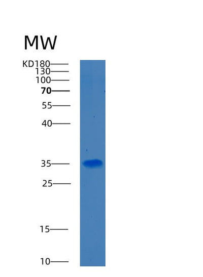 SDS-PAGE analysis of Human BDH1 (D-Beta-Hydroxybutyrate Dehydrogenase, Mitochondrial) - Recombinant Protein, CAT# BLT-00307P, showing >90% purity under 15% SDS-PAGE (Reduced)Human BDH1 (D-Beta-Hydroxybutyrate Dehydrogenase, Mitochondrial) - Recombinant Protein