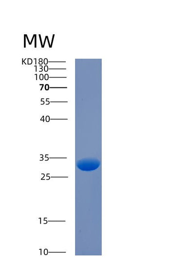 SDS-PAGE analysis of Human CA3 (Carbonic Anhydrase 3) - Recombinant Protein, CAT# BLT-00379P, showing >90% purity under 15% SDS-PAGE (Reduced)Human CA3 (Carbonic Anhydrase 3) - Recombinant Protein