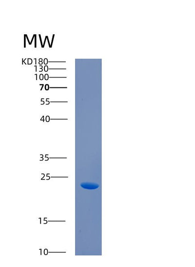 SDS-PAGE analysis of Human CABP7 (Calcium-Binding Protein 7) - Recombinant Protein, CAT# BLT-00383P, showing >85% purity under 15% SDS-PAGE (Reduced)Human CABP7 (Calcium-Binding Protein 7) - Recombinant Protein