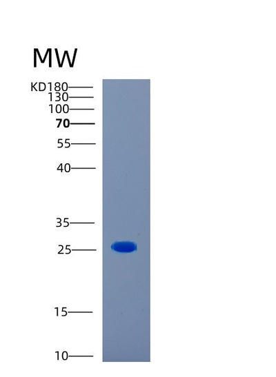SDS-PAGE analysis of Human CAPSL (Calcyphosin-Like Protein) - Recombinant Protein, CAT# BLT-00407P, showing >85% purity under 15% SDS-PAGE (Reduced)Human CAPSL (Calcyphosin-Like Protein) - Recombinant Protein