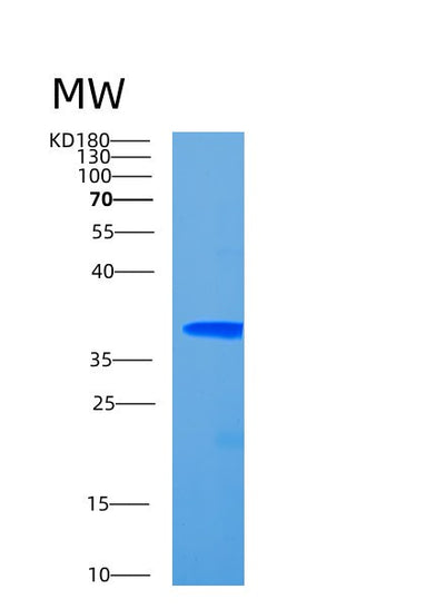 SDS-PAGE analysis of Human CCDC69 (Coiled-Coil Domain-Containing Protein 69) - Recombinant Protein, CAT# BLT-00432P, showing >85% purity under 15% SDS-PAGE (Reduced)Human CCDC69 (Coiled-Coil Domain-Containing Protein 69) - Recombinant Protein