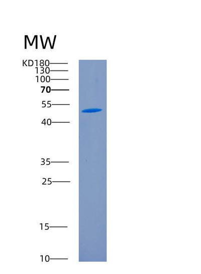 SDS-PAGE analysis of Human CD226 (Cd226 Antigen) - Recombinant Protein, CAT# BLT-00475P, showing >90% purity under 15% SDS-PAGE (Reduced)Human CD226 (Cd226 Antigen) - Recombinant Protein