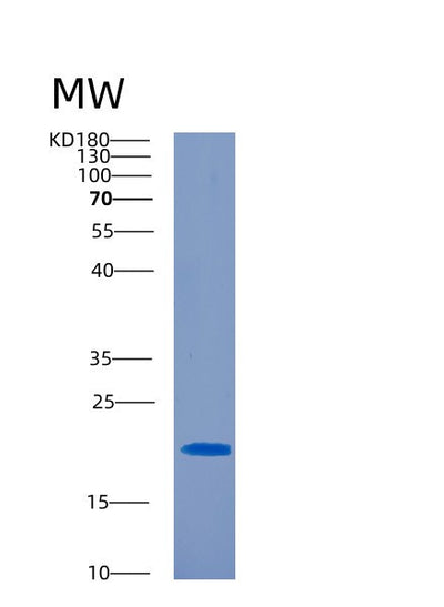 SDS-PAGE analysis of Human CD300C (Cmrf35-Like Molecule 6) - Recombinant Protein, CAT# BLT-00485P, showing >90% purity under 15% SDS-PAGE (Reduced)Human CD300C (Cmrf35-Like Molecule 6) - Recombinant Protein