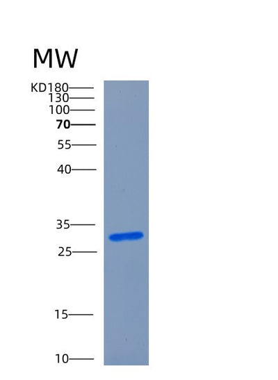 SDS-PAGE analysis of Human CHCHD3 (Micos Complex Subunit Mic19) - Recombinant Protein, CAT# BLT-00583P, showing >90% purity under 15% SDS-PAGE (Reduced)Human CHCHD3 (Micos Complex Subunit Mic19) - Recombinant Protein