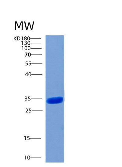 SDS-PAGE analysis of Human STUB1 (E3 Ubiquitin-Protein Ligase Chip) - Recombinant Protein, CAT# BLT-00588P, showing >95% purity under 15% SDS-PAGE (Reduced)Human STUB1 (E3 Ubiquitin-Protein Ligase Chip) - Recombinant Protein