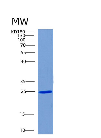 SDS-PAGE analysis of Human CHMP1B (Charged Multivesicular Body Protein 1B) - Recombinant Protein, CAT# BLT-00589P, showing >90% purity under 15% SDS-PAGE (Reduced)Human CHMP1B (Charged Multivesicular Body Protein 1B) - Recombinant Protein