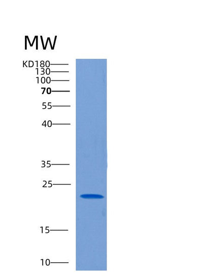 SDS-PAGE analysis of Human CLEC1B (C-Type Lectin Domain Family 1 Member B) - Recombinant Protein, CAT# BLT-00621P, showing >90% purity under 15% SDS-PAGE (Reduced)Human CLEC1B (C-Type Lectin Domain Family 1 Member B) - Recombinant Protein