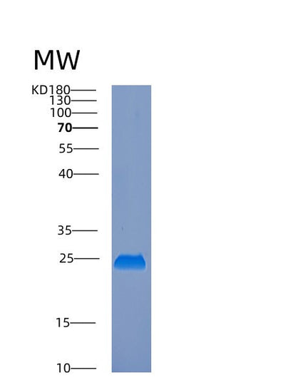 SDS-PAGE analysis of Human EMC8 (Er Membrane Protein Complex Subunit 8) - Recombinant Protein, CAT# BLT-00672P, showing >90% purity under 15% SDS-PAGE (Reduced)Human EMC8 (Er Membrane Protein Complex Subunit 8) - Recombinant Protein