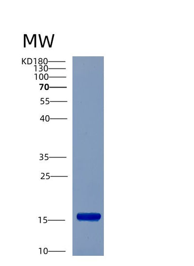 SDS-PAGE analysis of Human CST6 (Cystatin-M) - Recombinant Protein, CAT# BLT-00731P, showing >90% purity under 15% SDS-PAGE (Reduced)Human CST6 (Cystatin-M) - Recombinant Protein