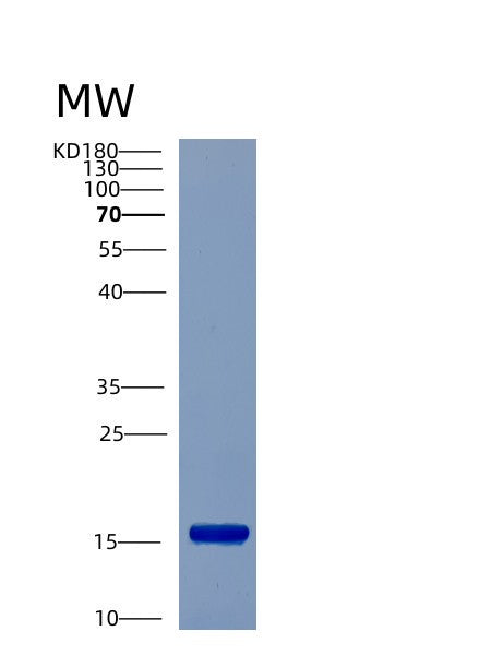 SDS-PAGE analysis of Human CST6 (Cystatin-M) - Recombinant Protein, CATHuman CST6 (Cystatin-M) - Recombinant Protein
