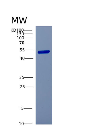 SDS-PAGE analysis of Human CSTF1 (Cleavage Stimulation Factor Subunit 1) - Recombinant Protein, CAT# BLT-00738P, showing >85% purity under 15% SDS-PAGE (Reduced)Human CSTF1 (Cleavage Stimulation Factor Subunit 1) - Recombinant Protein