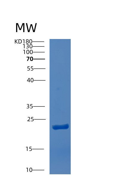 SDS-PAGE analysis of Human CTDSPL (Ctd Small Phosphatase-Like Protein) - Recombinant Protein, CATHuman CTDSPL (Ctd Small Phosphatase-Like Protein) - Recombinant Protein