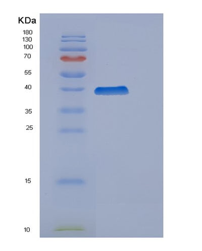 SDS-PAGE analysis of Human CCNH (Cyclin-H) - Recombinant Protein, CAT# BLT-00785P, showing >90% purity under 15% SDS-PAGE (Reduced)Human CCNH (Cyclin-H) - Recombinant Protein