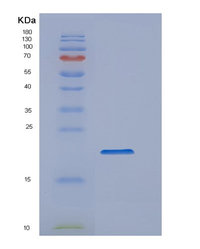 SDS-PAGE analysis of Human PPIA (Peptidyl-Prolyl Cis-Trans Isomerase A) - Recombinant Protein, CATHuman PPIA (Peptidyl-Prolyl Cis-Trans Isomerase A) - Recombinant Protein
