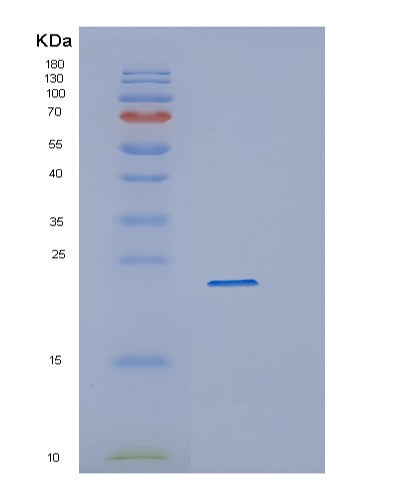 SDS-PAGE analysis of Human CYGB (Cytoglobin) - Recombinant Protein, CATHuman CYGB (Cytoglobin) - Recombinant Protein