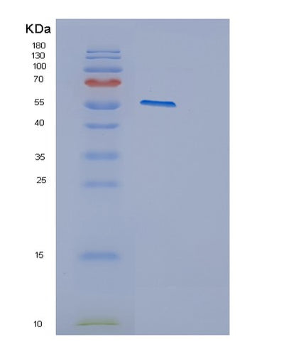 SDS-PAGE analysis of Human CYP2E1 (Cytochrome P450 2E1) - Recombinant Protein, CAT# BLT-00793P, showing >95% purity under 15% SDS-PAGE (Reduced)Human CYP2E1 (Cytochrome P450 2E1) - Recombinant Protein