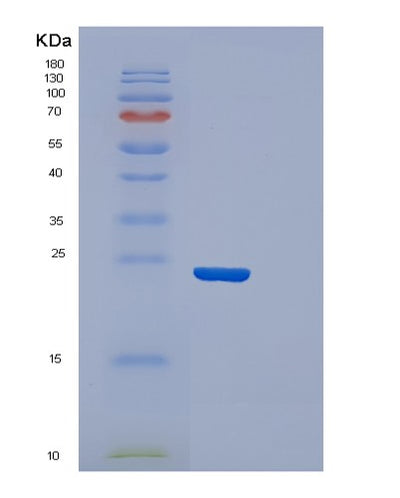 SDS-PAGE analysis of Human CDO1 (Cysteine Dioxygenase Type 1) - Recombinant Protein, CAT# BLT-00797P, showing >85% purity under 15% SDS-PAGE (Reduced)Human CDO1 (Cysteine Dioxygenase Type 1) - Recombinant Protein