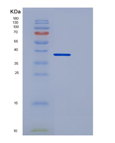 SDS-PAGE analysis of Human DCN (Decorin) - Recombinant Protein, CAT# BLT-00814P, showing >90% purity under 15% SDS-PAGE (Reduced)Human DCN (Decorin) - Recombinant Protein