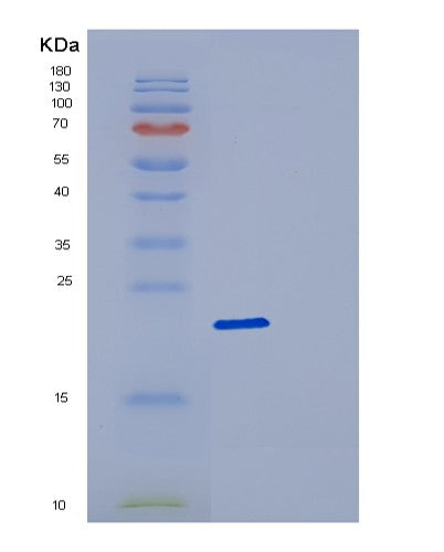 SDS-PAGE analysis of Human DCTD (Deoxycytidylate Deaminase) - Recombinant Protein, CATHuman DCTD (Deoxycytidylate Deaminase) - Recombinant Protein