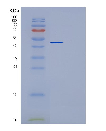 SDS-PAGE analysis of Human DCTN2 (Dynactin Subunit 2) - Recombinant Protein, CATHuman DCTN2 (Dynactin Subunit 2) - Recombinant Protein