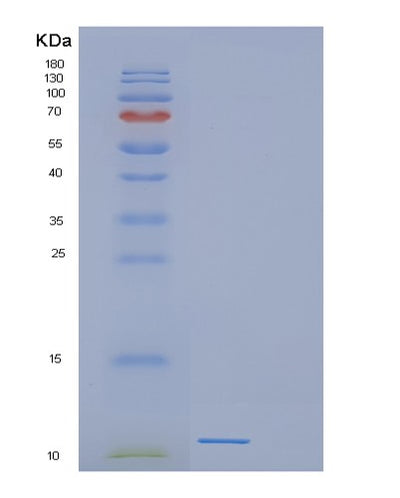 SDS-PAGE analysis of Human DEFB116 (Beta-Defensin 116) - Recombinant Protein, CAT# BLT-00836P, showing >85% purity under 15% SDS-PAGE (Reduced)Human DEFB116 (Beta-Defensin 116) - Recombinant Protein