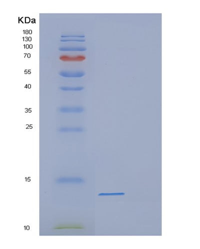 SDS-PAGE analysis of Human DEFB118 (Defensin Beta 118) - Recombinant Protein, CAT# BLT-00837P, showing >95% purity under 15% SDS-PAGE (Reduced)Human DEFB118 (Defensin Beta 118) - Recombinant Protein