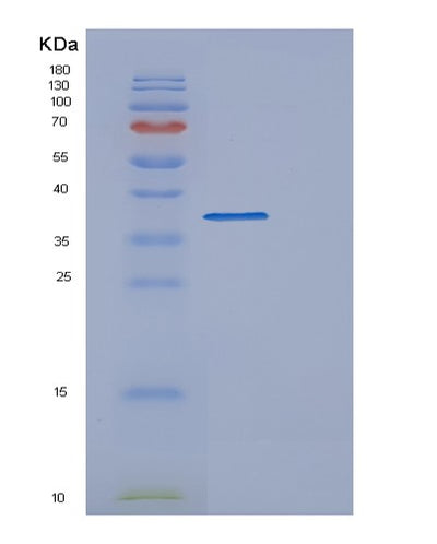 SDS-PAGE analysis of Human DFFA (Dna Fragmentation Factor Subunit Alpha) - Recombinant Protein, CAT# BLT-00842P, showing >90% purity under 15% SDS-PAGE (Reduced)Human DFFA (Dna Fragmentation Factor Subunit Alpha) - Recombinant Protein