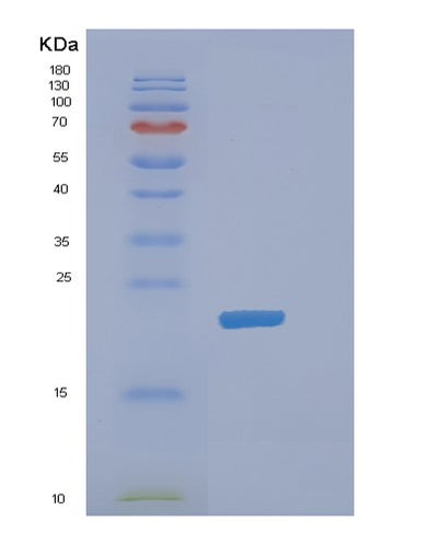 SDS-PAGE analysis of Mouse Dhfr (Dihydrofolate Reductase) - Recombinant Protein, CAT# BLT-00846P, showing >85% purity under 15% SDS-PAGE (Reduced)Mouse Dhfr (Dihydrofolate Reductase) - Recombinant Protein