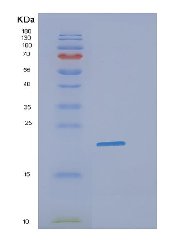 SDS-PAGE analysis of Human DHH (Desert Hedgehog Protein) - Recombinant Protein, CAT# BLT-00848P, showing >90% purity under 15% SDS-PAGE (Reduced)Human DHH (Desert Hedgehog Protein) - Recombinant Protein