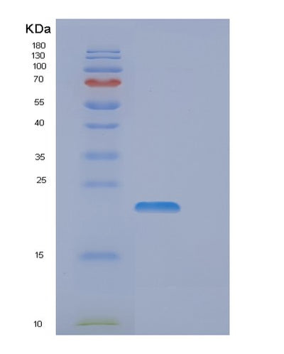SDS-PAGE analysis of Human DLX3 (Homeobox Protein Dlx-3) - Recombinant Protein, CAT# BLT-00862P, showing >95% purity under 15% SDS-PAGE (Reduced)Human DLX3 (Homeobox Protein Dlx-3) - Recombinant Protein