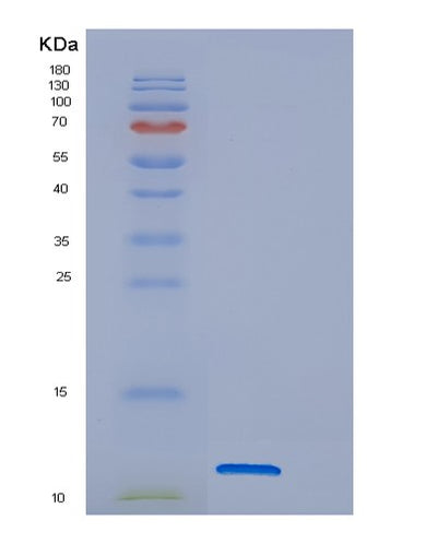 SDS-PAGE analysis of Human DNAJC15 (Dnaj Homolog Subfamily C Member 15) - Recombinant Protein, CAT# BLT-00870P, showing >95% purity under 15% SDS-PAGE (Reduced)Human DNAJC15 (Dnaj Homolog Subfamily C Member 15) - Recombinant Protein
