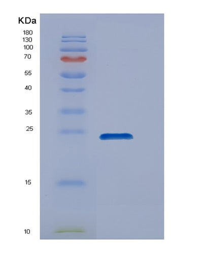 SDS-PAGE analysis of Human DUSP18 (Dual Specificity Protein Phosphatase 18) - Recombinant Protein, CAT# BLT-00899P, showing >85% purity under 15% SDS-PAGE (Reduced)Human DUSP18 (Dual Specificity Protein Phosphatase 18) - Recombinant Protein