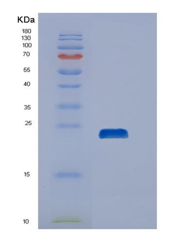 SDS-PAGE analysis of Human DUSP21 (Dual Specificity Protein Phosphatase 21) - Recombinant Protein, CAT# BLT-00901P, showing >90% purity under 15% SDS-PAGE (Reduced)Human DUSP21 (Dual Specificity Protein Phosphatase 21) - Recombinant Protein