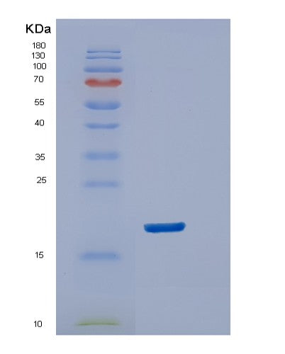 SDS-PAGE analysis of Human DUSP23 (Dual Specificity Protein Phosphatase 23) - Recombinant Protein, CATHuman DUSP23 (Dual Specificity Protein Phosphatase 23) - Recombinant Protein
