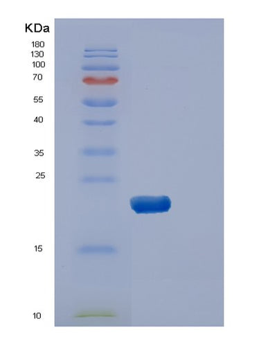 SDS-PAGE analysis of Human DUSP3 (Dual Specificity Protein Phosphatase 3) - Recombinant Protein, CAT# BLT-00906P, showing >95% purity under 15% SDS-PAGE (Reduced)Human DUSP3 (Dual Specificity Protein Phosphatase 3) - Recombinant Protein