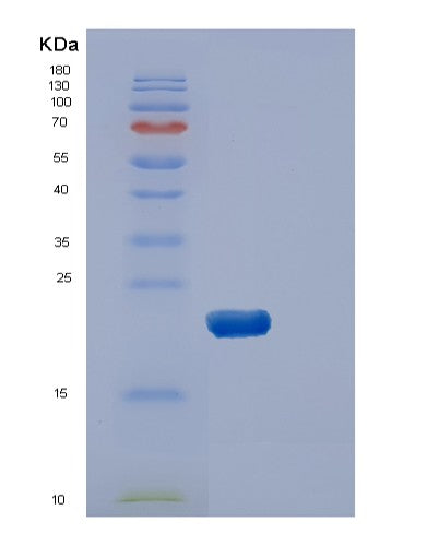 SDS-PAGE analysis of Human DUSP3 (Dual Specificity Protein Phosphatase 3) - Recombinant Protein, CATHuman DUSP3 (Dual Specificity Protein Phosphatase 3) - Recombinant Protein