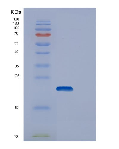 SDS-PAGE analysis of Human DUT (Deoxyuridine 5'-Triphosphate Nucleotidohydrolase, Mitochondrial) - Recombinant Protein, CAT# BLT-00908P, showing >85% purity under 15% SDS-PAGE (Reduced)Human DUT (Deoxyuridine 5'-Triphosphate Nucleotidohydrolase, Mitochondrial) - Recombinant Protein