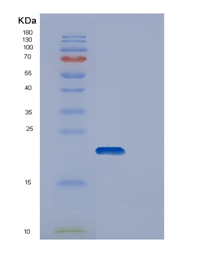 SDS-PAGE analysis of Human DUT (Deoxyuridine 5&Human DUT (Deoxyuridine 5'-Triphosphate Nucleotidohydrolase, Mitochondrial) - Recombinant Protein