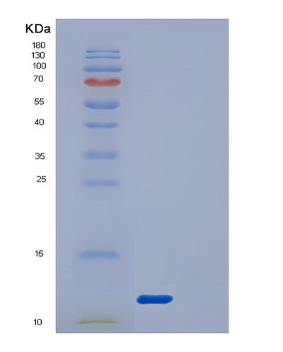 SDS-PAGE analysis of Human DYNLRB1 (Dynein Light Chain Roadblock-Type 1) - Recombinant Protein, CAT# BLT-00911P, showing >85% purity under 15% SDS-PAGE (Reduced)Human DYNLRB1 (Dynein Light Chain Roadblock-Type 1) - Recombinant Protein