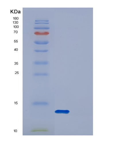 SDS-PAGE analysis of Human DYNLRB2 (Dynein Light Chain Roadblock-Type 2) - Recombinant Protein, CAT# BLT-00912P, showing >95% purity under 15% SDS-PAGE (Reduced)Human DYNLRB2 (Dynein Light Chain Roadblock-Type 2) - Recombinant Protein