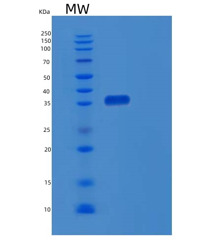 SDS-PAGE analysis of Human EBNA1BP2 (Probable Rrna-Processing Protein Ebp2) - Recombinant Protein, CATHuman EBNA1BP2 (Probable Rrna-Processing Protein Ebp2) - Recombinant Protein