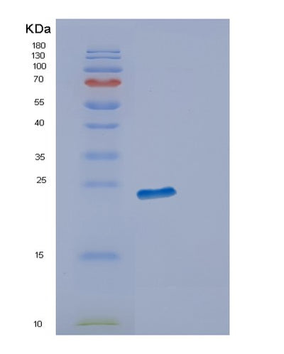 SDS-PAGE analysis of Human ECSIT (Evolutionarily Conserved Signaling Intermediate In Toll Pathway, Mitochondrial) - Recombinant Protein, CAT# BLT-00925P, showing >85% purity under 15% SDS-PAGE (Reduced)Human ECSIT (Evolutionarily Conserved Signaling Intermediate In Toll Pathway, Mitochondrial) - Recombinant Protein